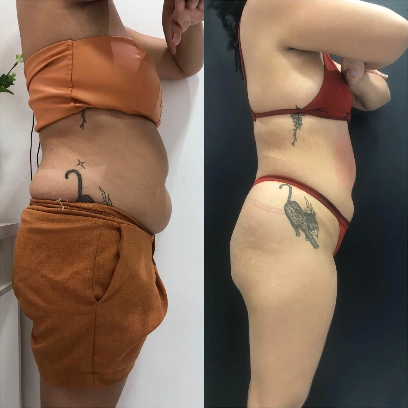 Antes e depois redução de medidas, corpo de perfil
